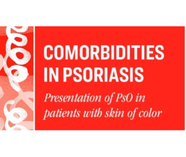 comorbidities in psoriasis presentation of Ps0 in patients with skin of color